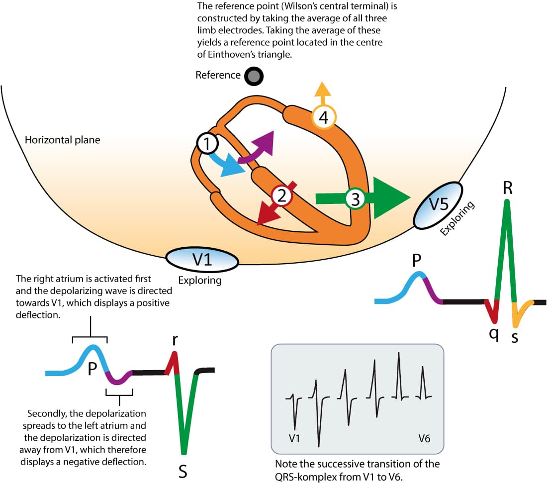 Figure 7. The heart's main electrical vectors seen from the horizontal plane. V1 and V5 are exploring electrodes and the reference is composed of the average of the electrodes placed on the limbs (this reference is called Wilson's central terminal). Inspired by MacFarlane et al (Springer, Comprehensive Electrocardiology, 2010).