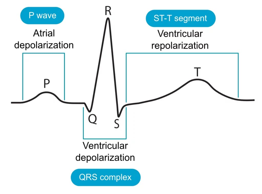 Figure 4. The classical ECG curve and the events reflected on it. The ECG curve above displays a QRS complex consisting of Q-, R- and S-wave. Even if one or two waves would be missing from the QRS complex, it would still be referred to as the QRS complex.